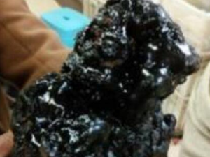 Ѫ��֬�Ĺ�Ч�����ú�ҩ�ü�ֵ