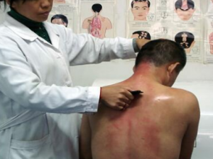 ����ǰ��������ҩ����Ч����ô�� ����ǰ�����׵����Ʒ���