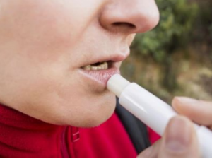 �촽������Ƥ��λ��� �촽������Ƥ��ԭ��