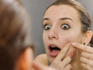 ��ʲôҩ���ǿ�����ߵ��� ��ߵ�ƫ���Ƽ�