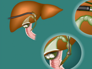 ���Ե����׵����Ʒ��� ���Ե����׵���ҽƫ��