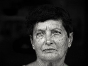 Ƥ�����������˷�ɫ������ ��Щ���ص���Ƥ�����