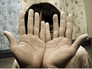 ţƤѢӦ������� ����ţƤѢ��ƫ���Ƽ�