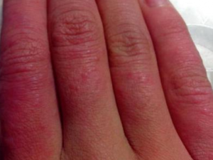 ��������ô���� ��Щ�����ɻ��ⶳ��