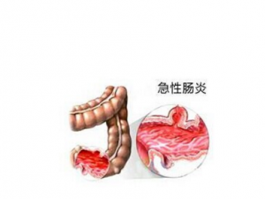 ���Գ��׷�����Щ ���Գ��׵����Ʒ���