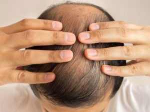 ���������ѷ���ԭ�� ���������ѷ����������