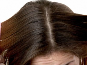 ��ô����ͷ�������� �ճ�Ӧ����ô����ͷ��