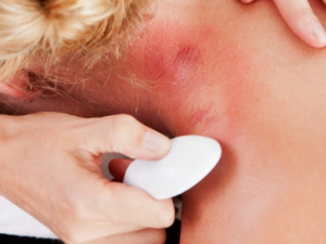 ��ôԤ������ ��ҽ���Ʊ��ص�ƫ��