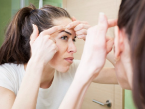 ֬����Ƥ����ʲôҩ ֬����Ƥ����ҽƫ������Щ