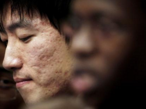 ��ҽ��������ഺ�� �ഺ�������Ʒ���