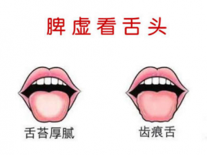 �̵�7����ҩСƫ������Ƣ��