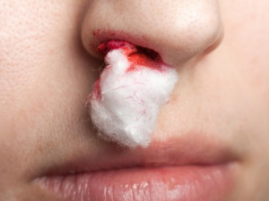 ����Ѫ����δ��� ����Ѫ��ԭ��