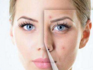 ��������Ч�������ƫ��