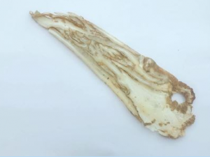 ��ҽ��ѹ����Щ���� ��ҽ��ѹ��ƫ��