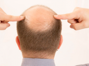 ����ͷ����ô���� ����ͷ��ԭ��