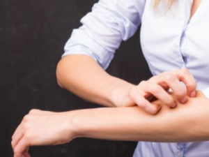 �ճ���ʪ�ķ����Ƽ� ����ʪ���ص�ԭ��