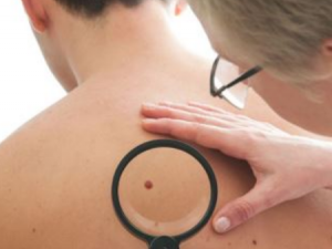 �컨������Щ��Ч �컨�͵�����