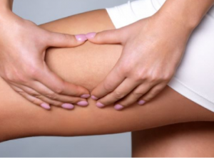 ��֫����Ҫ��ô��ů