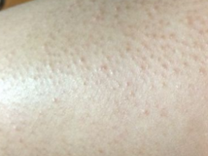 �������н����Ƥ��