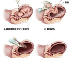 �ʸ�������ʲô�����