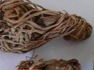 ʲô�ǿ��޲� ���޲��Ĺ�Ч������