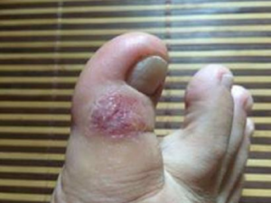 ������Сˮ����ô���� ���ƽ�������Щƫ��