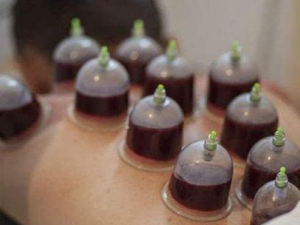 �ι�����Щ��Ч �ι޵ĺô�