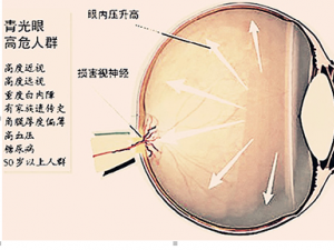 ����ۻ����ճ�Ҫ��λ���