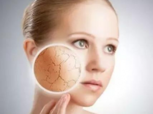 ����Ƥ������ȱˮӦ��α���