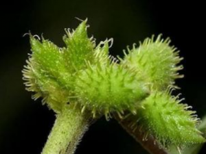 ���ڲ�ѪҪע��ʲô ���ڲ�Ѫ�ı�Ҫ��