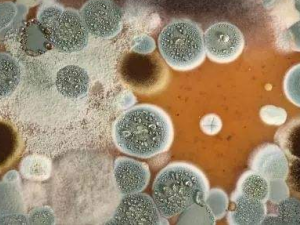 ë���Ӿ�������Щ֢״ ë���Ӿ���������ƫ��