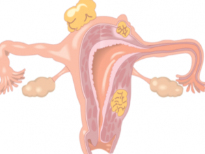 �����ӹ�������ʲôΣ��