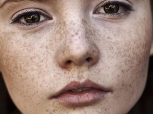 Ƥ���ڰߵ�ԭ�� Ƥ���ڰ��������