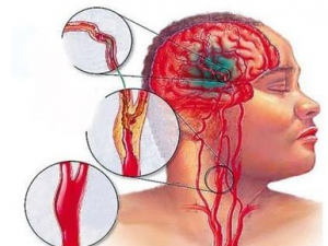 �⻯ֲ������ʳ���� �⻯ֲ���͵�ʳ�ý���