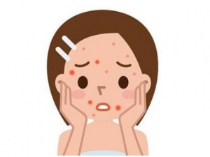 ��������Щ֢״ ���̵�����ƫ��