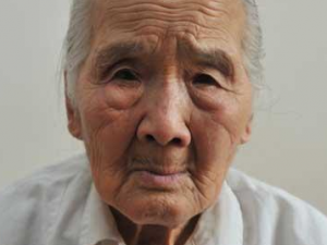 Ǯ��״ʪ������Щ֢״ Ǯ��״ʪ�������ƫ��