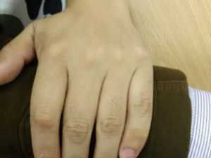 �����Ĵ�����������Щ �����Ĵ�ĺô�