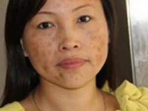 �����лƺְ���ô�� ��ҽ����������ƻƺְ�