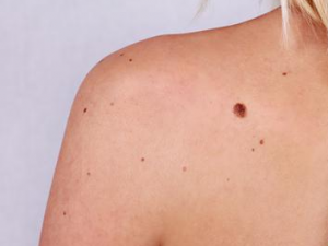 ��ô����̥�� ��Щ����������̥��