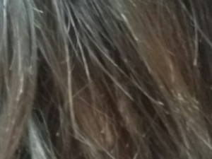 ͷ�����͵�ԭ������Щ ���ע�Ᵽ��ͷ��