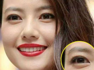 �촽�ķ�ɹ������ô���� ��ʿ���촽��λ���