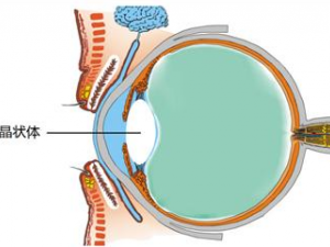 ���������κ��� �����ϵ���ҽ����ƫ��