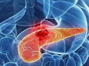 �������ɷ���ֱ���� ֱ����������ƫ��