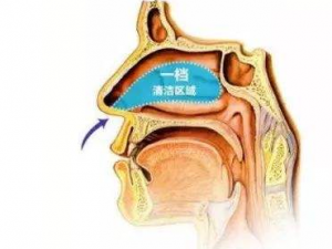 ���������Ԥ������ ���Ʊ��׵�ƫ������Щ