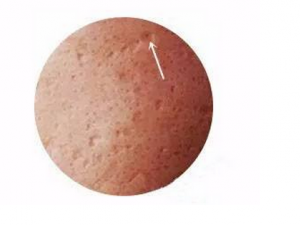 �ںڵĶ�ӡӰ������������ ��ҽ����Щ��ҩ�ӡ