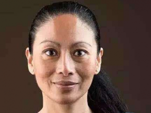 ��ҽȥȸ�ߵĺ÷��� �ճ���ȸ�ߵĻ���������ʲô