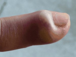 ��ҽ���������Щ���� ����������������ζ