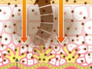 ���Ԥ����֢ ��֢��ҽ��ƫ��