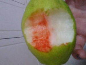 ����������Ѫ��ԭ������Щ ��ҽӦ�����������