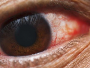 ���Ĺ�����Щ�����߷� Ӧ�������Ԥ����